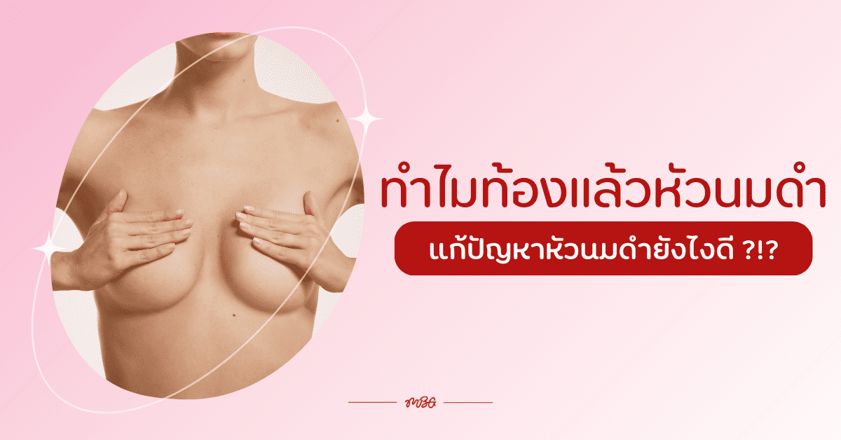 หัวนมดำ